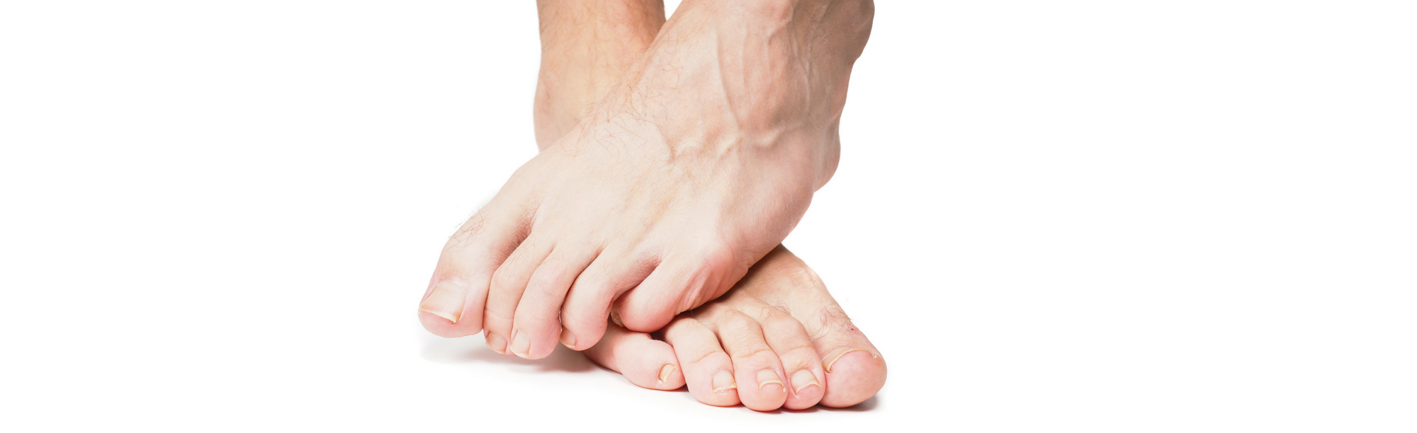 Spasms, Cramps, and Charley Horses…..Oh My! Foot Cramp 1 Spasms, Cramps, and Charley Horses…..Oh My!
