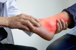 Ankle Pain Treatment