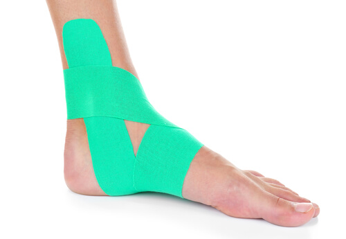 Sprained Ankle Recovery FAQ