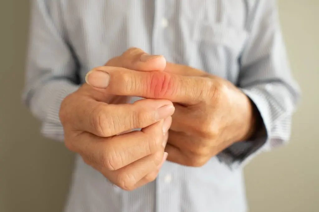 Physical Therapy for Trigger Finger AdobeStock 338384422 physical therapy for trigger finger hand pain